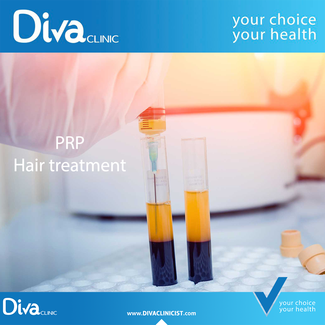 PRP Benefits for hair
