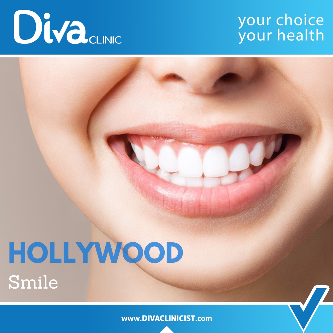 The cost of Hollywood smile
